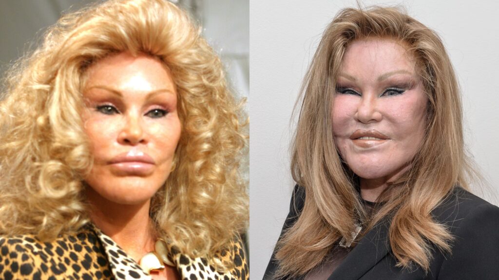 Jocelyn Wildenstein: El Mito de la ‘Mujer Gato’