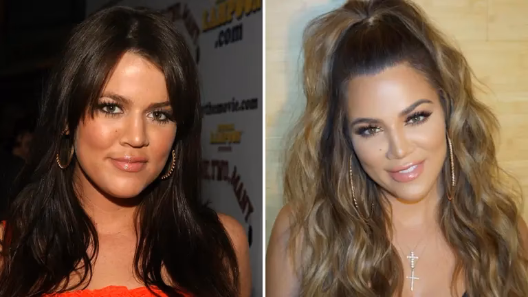 ¿Cuántas operaciones ha hecho Khloé Kardashian?