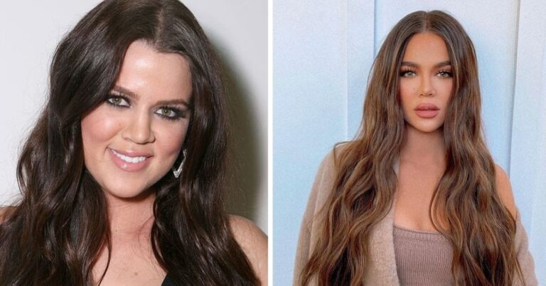 Khloé Kardashian: Todas Sus Cirugías y Tratamientos