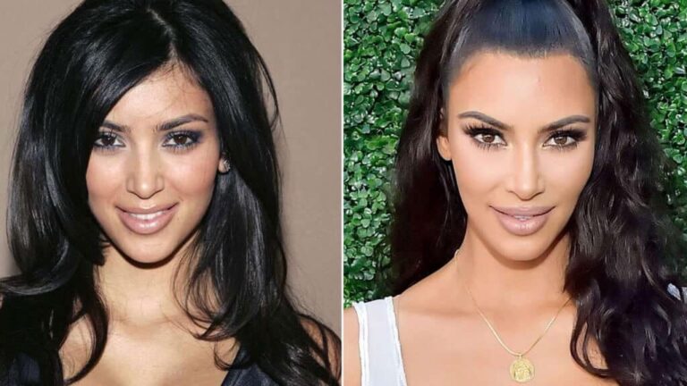 Cirugías del Clan Kardashian al Descubierto