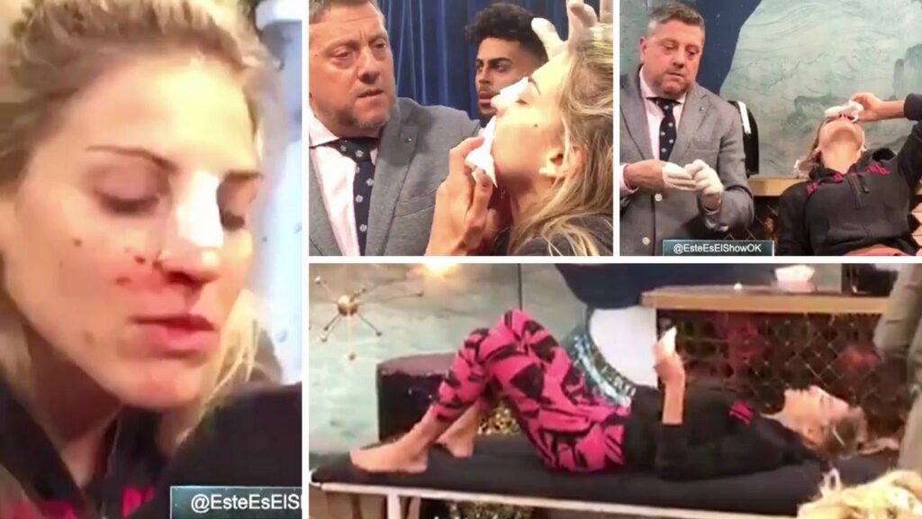 Ariana Grande: La Cirugía que Cambió su Rostro