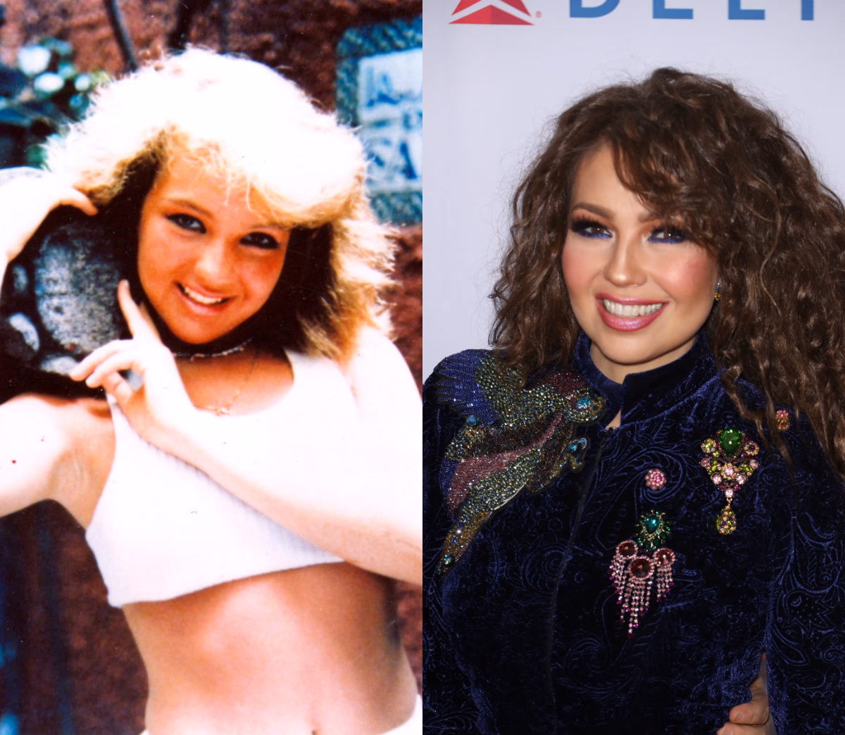 ¿Thalia se sometió a alguna cirugía?