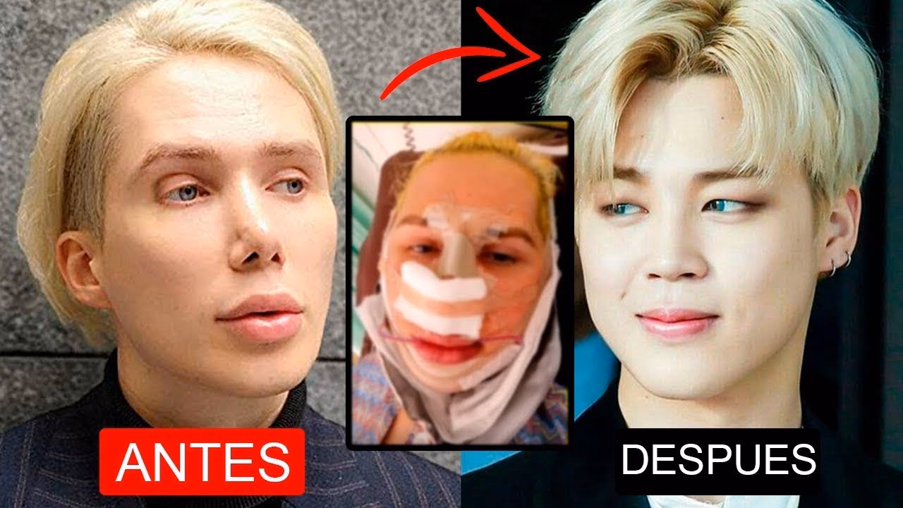 ¿Qué operaciones tienen los miembros de BTS?