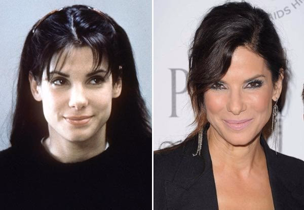¿Qué se ha hecho Sandra Bullock en la cara?