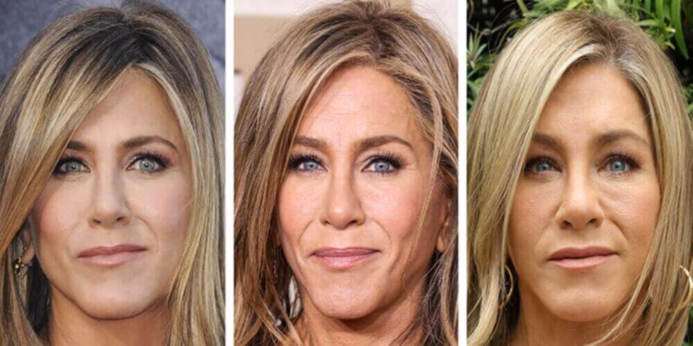 ¿Qué cirugías se ha hecho Jennifer Aniston?