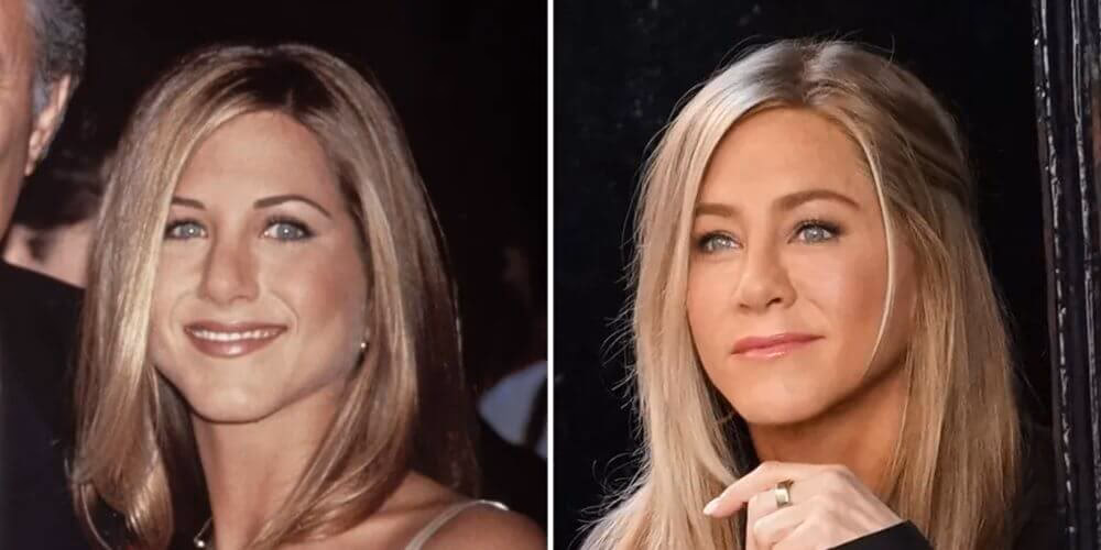 ¿Jennifer Aniston tiene la nariz operada?