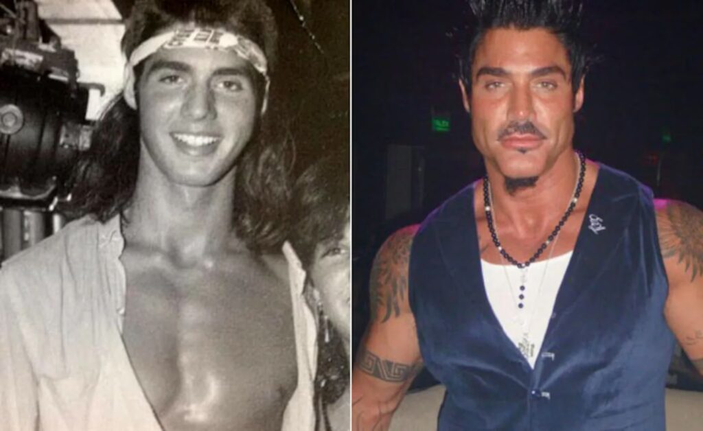 Ricardo Fort: Las 27 cirugías de una obsesión