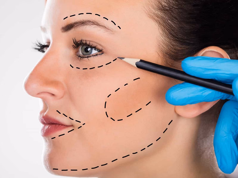 ¿Es bueno tomar colágeno después de una cirugía?