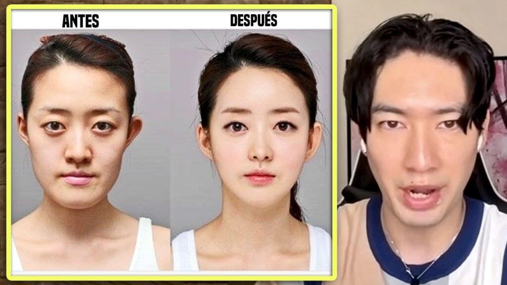 Cirugía Plástica en Corea: Salarios y Precios