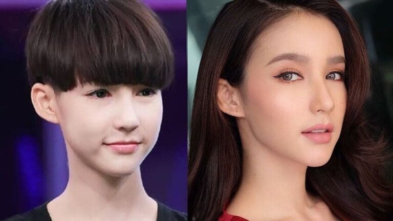 Cirugía Plástica en Tailandia: Guía de Costos