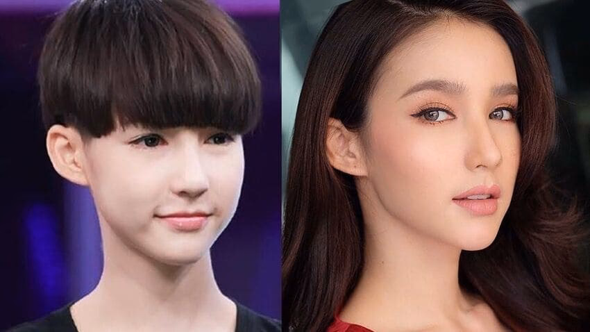 Cirugía Plástica en Tailandia: Guía de Costos