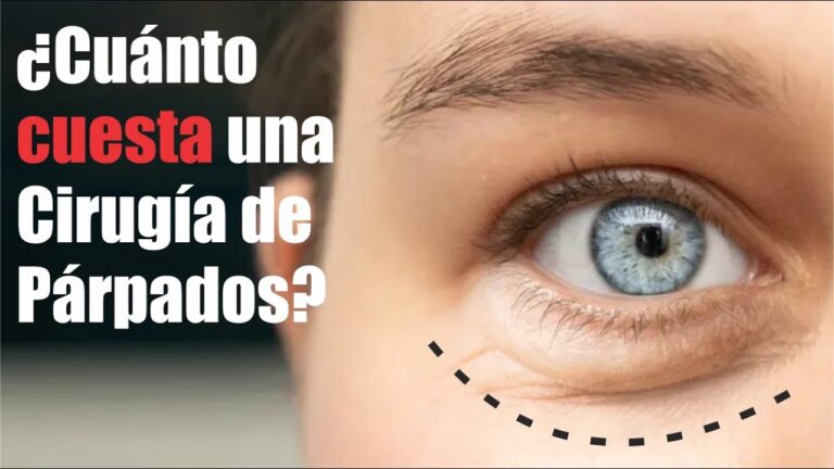 Blefaroplastia: Guía de Precios y Recuperación