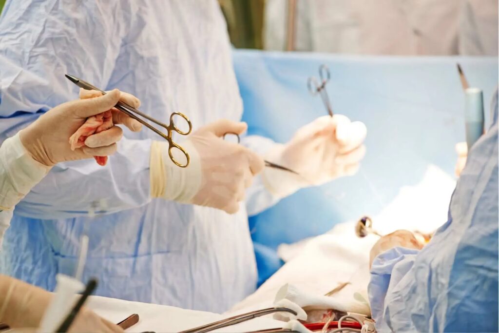 Abdominoplastia: Incapacidad y Derechos del Paciente