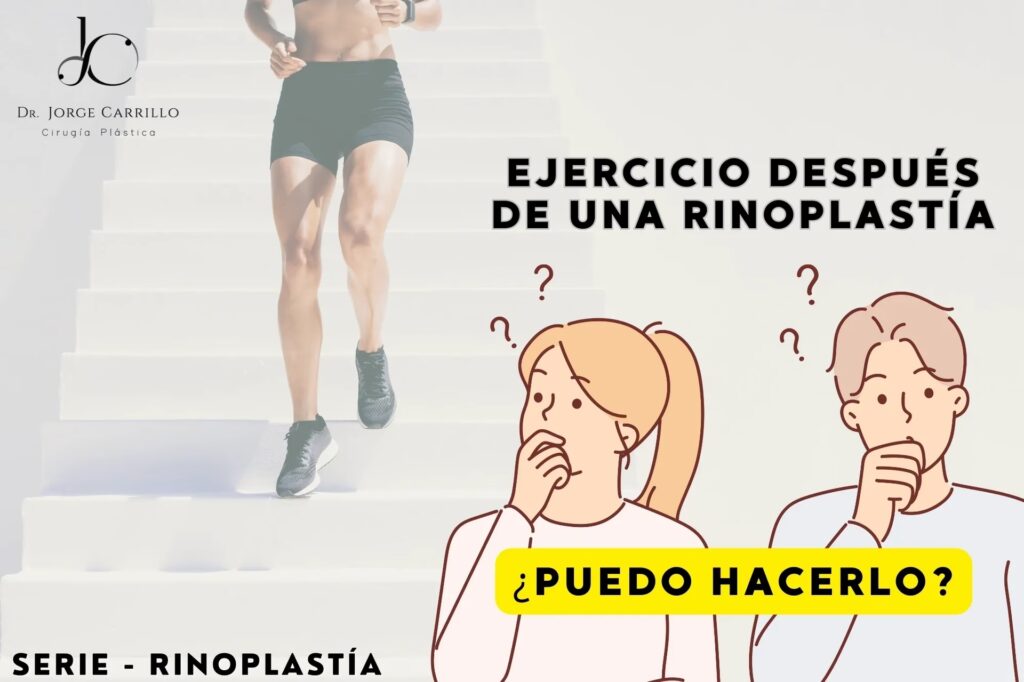 Ejercicio tras una Rinoplastia: Tiempos y Guía