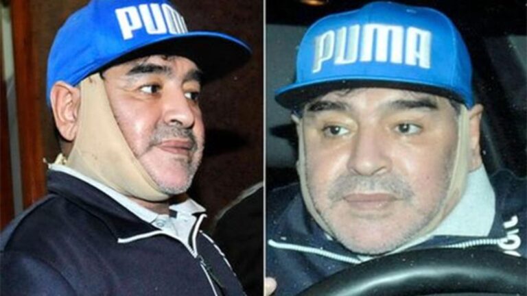 Maradona: La Cirugía Cerebral que lo Salvó