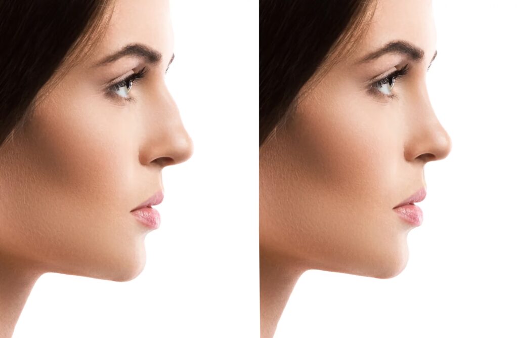 Diagnóstico Facial: La Clave de una Piel Perfecta
