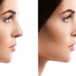 Cirugía Reconstructiva vs. Reparadora: Claves