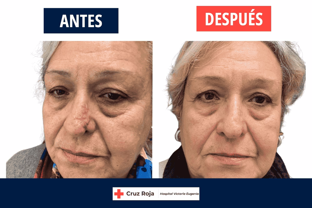 ¿Cuál es la diferencia entre la cirugía reparadora y la reconstructiva?