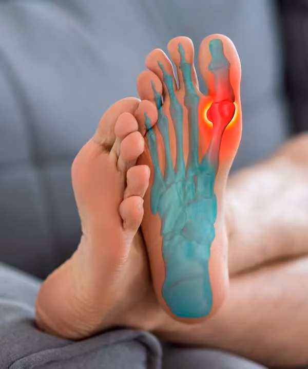 ¿Cuánto tarda en desinflamar el pie después de una cirugía?