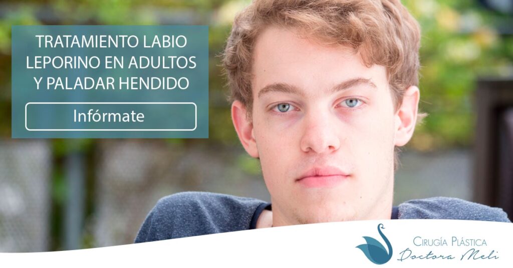 Cirugía de Paladar Hendido en Adultos: Tu Guía