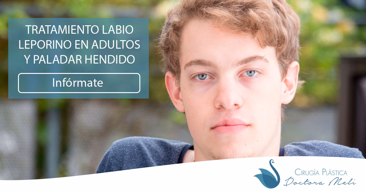 ¿Se puede operar el paladar hendido en adultos?