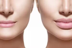 Dr. Alvaro Jaurretche “Medicina Estética”