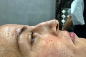 Dr Eduardo sosa cirujano plástico