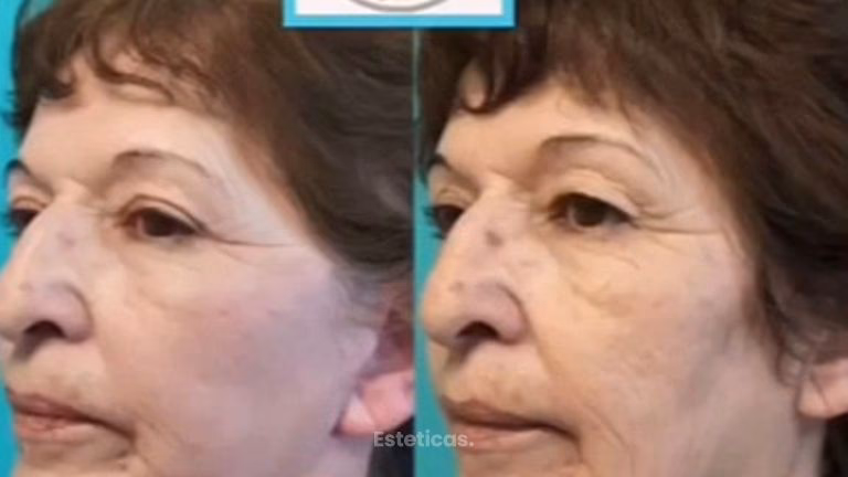 Dr. Rizk: Cirugía Ortopédica Robótica Avanzada