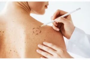 Dra Vanesa Ovejero. DermatólogiaEstetica