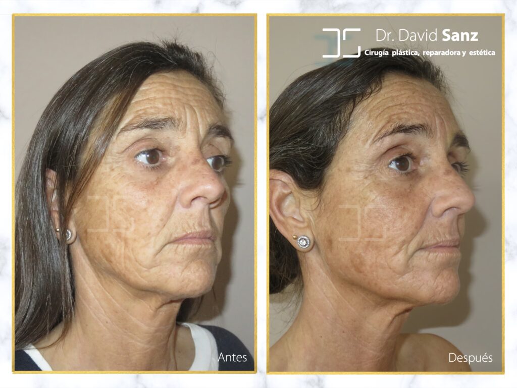 Formación en Cirugía Plástica en EEUU: Duración y Vías