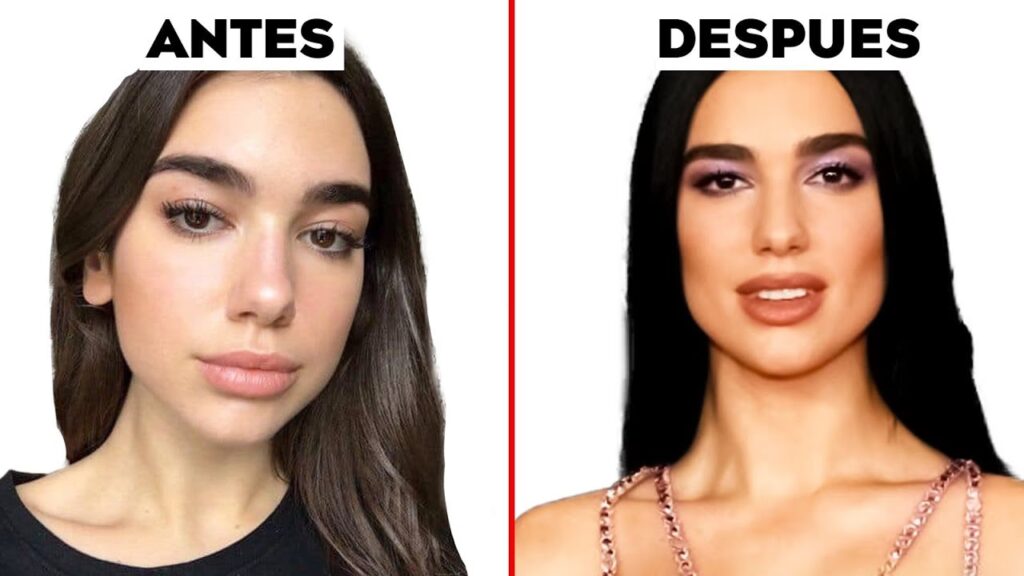 Dua Lipa: ¿Cirugía Plástica o Genética?