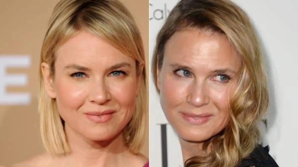 El Misterio del Rostro de Renée Zellweger