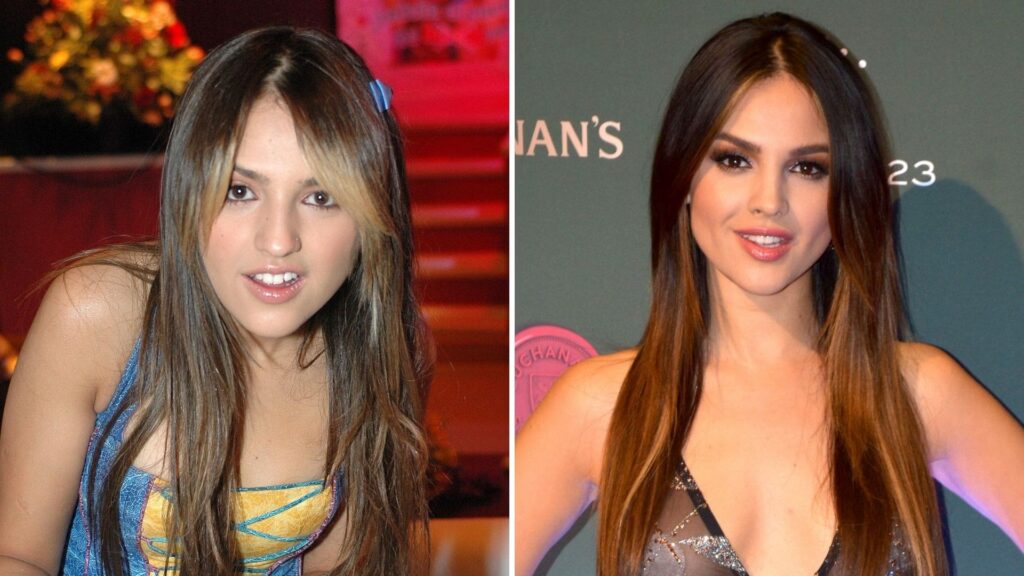 La Transformación de Eiza González: Sus Cirugías