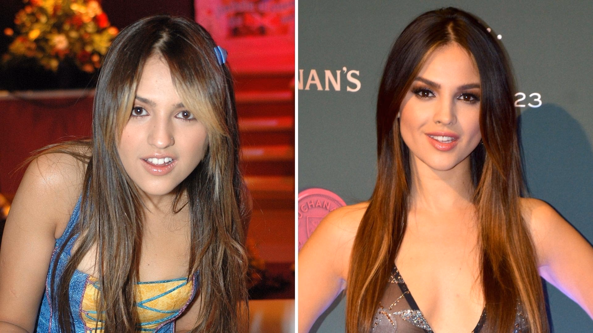 ¿Qué cirugía se hizo Eiza González?