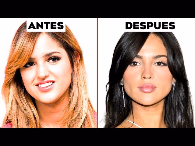 ¿Qué cirugía se hizo Eiza González?