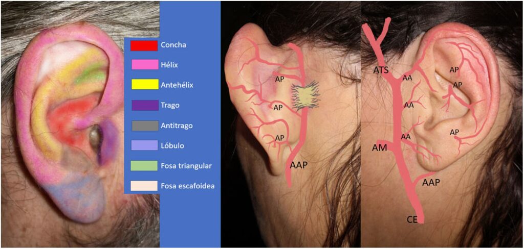 Otoplastia y Cirugía de Mohs: Guía Esencial