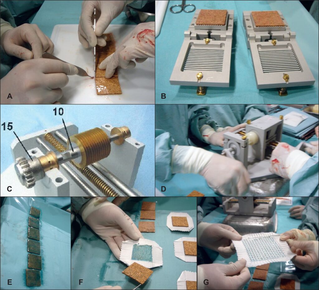 Expansión Tisular: Guía Completa y Riesgos