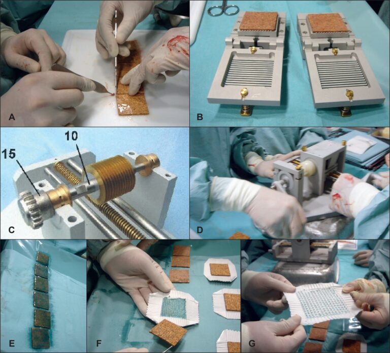 Expansión Tisular: Guía Completa y Riesgos