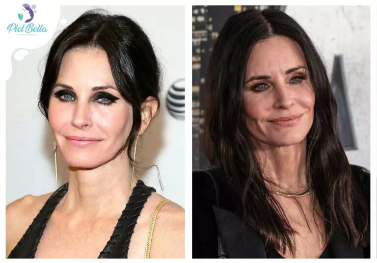 Guía Completa de la Cirugía de Feminización