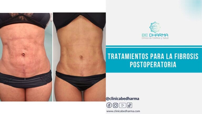 Fibrosis en la Piel: ¿Qué es y Cómo se Trata?