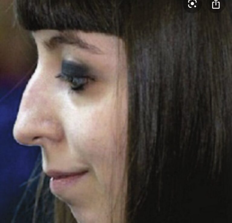 Flor de la V y la Vaginoplastia: Su Decisión