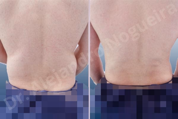 ¿Cómo eliminar la barriga de flotador?