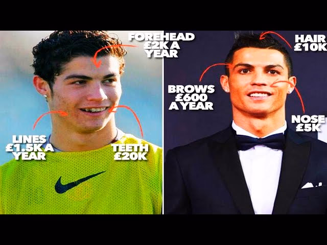 ¿Cómo se llama el futbolista que se operó?