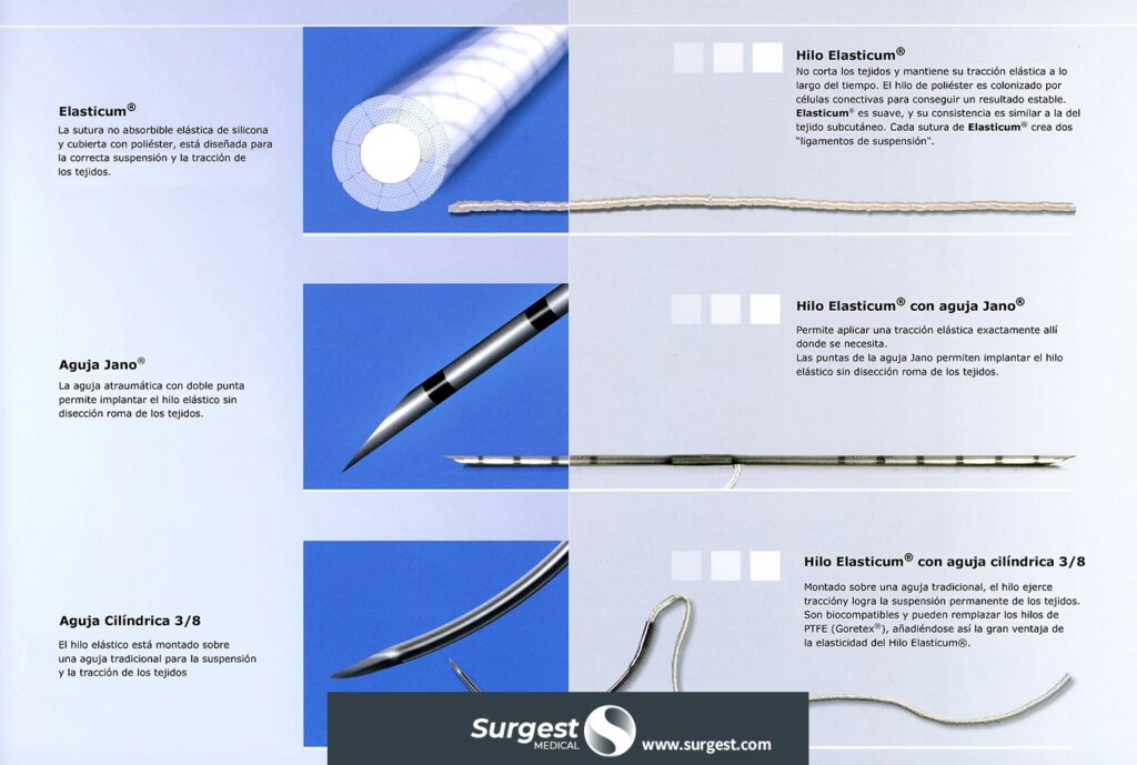 Hilos de Sutura en Cirugía: Guía Completa
