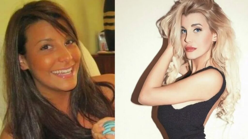 Cirugía Plástica: La Influencia de las Celebridades