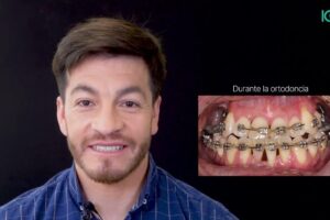 ICOR: Transformando Vidas con Cirugía Maxilofacial