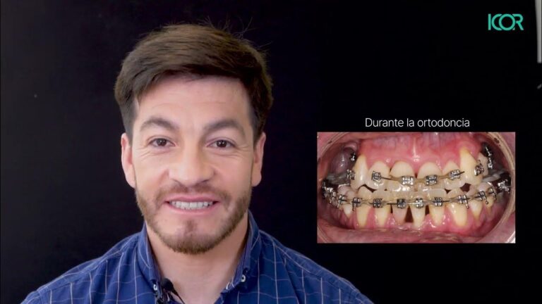 ICOR: Transformando Vidas con Cirugía Maxilofacial