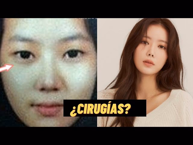 ¿Qué operaciones se ha hecho Nicki Minaj?