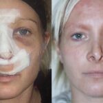 Cirugía Plástica: ¿Qué dice la Biblia al respecto?