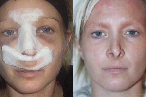 Cirugía Plástica: ¿Qué dice la Biblia al respecto?